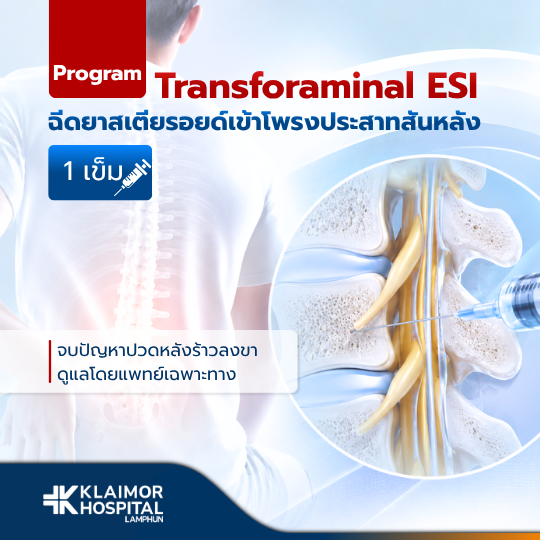 ฉีดยาสเตียรอยด์เข้าโพรงประสาทสันหลัง 1 เข็ม