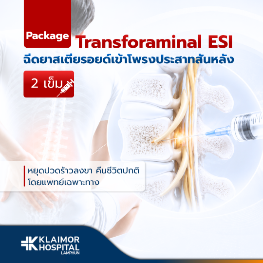 ฉีดยาสเตียรอยด์เข้าโพรงประสาทสันหลัง 2 เข็ม